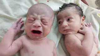 Cutest Twins Newborn Babies after birth where one is fed up with other one cry