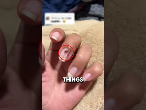 NAIL DIRT💅 Under The MICROSCOPE 😱
