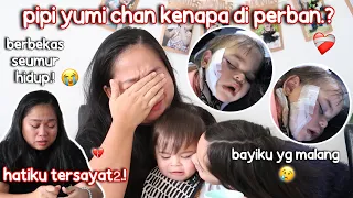 TRAGEDI PIPI YUMI CHAN, BERBEKAS SEUMUR HIDUP || HATIKU YG TERSAYAT2.!