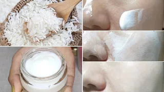 Summer Whitening Cream-मुश्किल झाईयां कालापन HyperPigmentation Melasma+Dark Spots करे साफ़ 7 Days में