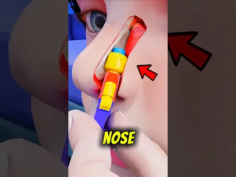 He Stuck a Lego Up His Nose - 26 Years Later, You Won't Believe What Came Out‼️😱