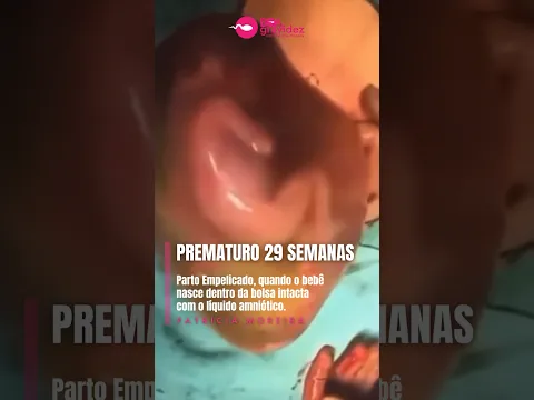 29 semanas de gestação