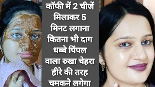 करवा चौथ पर 5 मिनट में चेहरा चमकाने का 100% असरदार तरीका चेहरा इतना गोरा टाइट होगा सब देखते रहजाएंगे