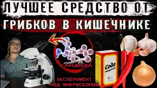 Лучшее средство от грибков в кишечнике. Полная версия эксперимента под микроскопом