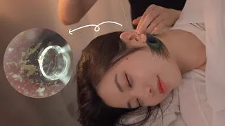 ASMR 보면서 받는 귀청소👂 | 내시경 구름칼 공작털 솜털 | Visual Ear Cleaning asmr