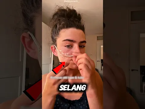 Menahan Sakit Demi Bertahan Hidup ‼️😱