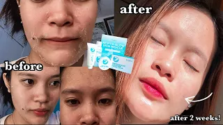 GRABE TO! THE BEST REJUV SET! (NO HAPDI AT SAKIT) 😱 ft. HerSkin by Kath Melendez HONEST REVIEW