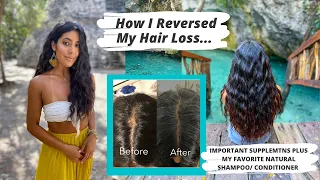 How I Reversed My Hair Loss// Why I lost It // What I Took And Did