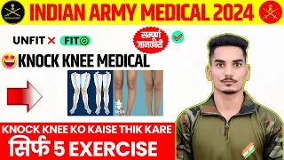 Knock knee कैसे ठीक करें | Knock knee problem solution | knock knees best 5 exercise in Hindi