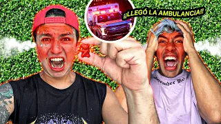 PARCERICO COME LA GOMITA MAS PICANTE DELMUNDO *Acabó en el hospital*