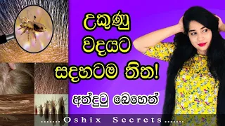 උකුණු වදයට සදහටම තිත|අත්දුටු බෙහෙත්|How to remove head lice