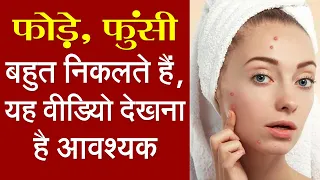 आसान घरेलू नुस्खों से करें चेहरा सफाई ||  Sulemani Nuskhe