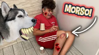 UGO HA MORSO ALESSANDRO E…