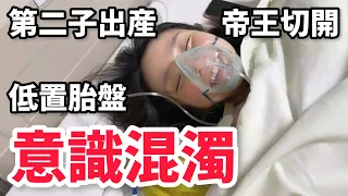 【帝王切開】命がけの出産「全て」を見せます