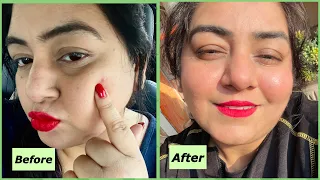 My experience with Garnier vitamin c Serum | Serum for all skin types & seasons | JSuper Kaur