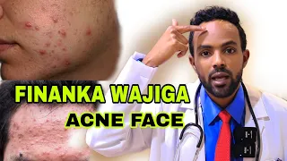 3 SHAY FINANKA WAJIGA LAGU DAWEEYO