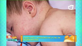 ¿Qué hacer cuando un niño tiene sarpullido?