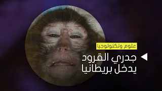 جدري القرود.. مرض غريب ينتشر في بريطانيا