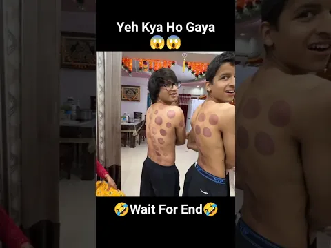 Body Mein Kya Ho Gaya 😱 #shorts #youtubeshorts