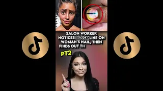 SALON WORKER NOTICES BLACK LINE ON WOMANS NAIL
