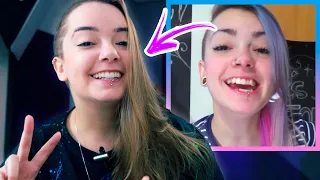 ARRUMEI MEUS DENTES! TUDO SOBRE O TRATAMENTO (E PREÇO!)