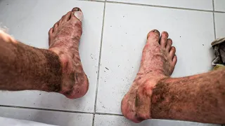 THE 100K RUN | Aftermath