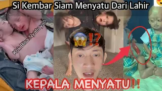 Si Kembar Menyatu Dari Kecil Kasian Banget😭 || Sukriadi Eps 3 #trending #viral