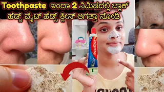How to remove Blackhead or whitehead from nose in just 2 minutes.