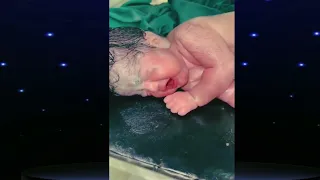 سبحانك ربي ما اعظمك. شكرا لهذا الطبيب و لكل الاطقم  التي تسعى لتقديم كل ما بوسعها لإنقاذ الارواح