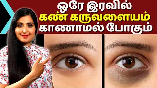 OVERNIGHT Dark Circles Remedy/ ஒரே இரவில் கருவளையங்களைப் போக்க|/ Undereye Cream  #Darkcircle