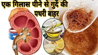 Kidney Stone Nikalne Ka Asan Tarika | गुर्दे की पथरी निकालने के उपाय | How to Remove Renal Stone