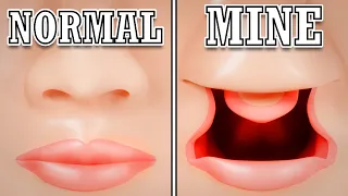 I was Born with an "Um, Actually" Voice, Here's Why