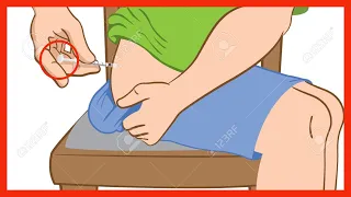 Cómo APLICAR inyección Intramuscular (Uno mismo)