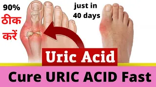 How To Cure Uric Acid Naturally | 90% ठीक करें just in 40 days