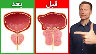 أَهَمُّ عُنْصُرٍ غِذَائِيٍّ  لِتَصْغِيرِ البُرُوسْتَاتَا | تَخَلَّصْ مِنْ تَكْرَارِ التَّبَوُّلِ