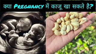 क्या गर्मियो की Pregnancy मे काजू खा सकते है? Can we eat cashews during summer pregnancy? #pregnancy