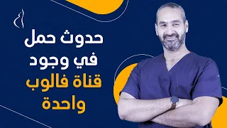 هل قناة فالوب واحدة كفاية لحدوث الحمل؟ د. أحمد حسين