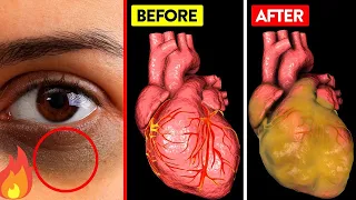 8 Daily BAD Habits that increase your Heart Attack Risk