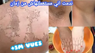 أقسم بالله أقوي وصفه لتبييض تخلي وجهك وجسمك بياض كالتلج