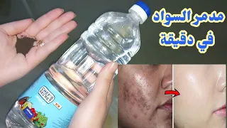 عشرينيه تقسم نصحنى به طبيب جزائري كان وجهي مدمر سواد والتهاب أصبح ابيض من الثلج وكل من رأى وجهي تعجب
