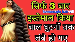 मात्र 2 रुपये मै रातों रात अपने बालों को बढ़ाये 😱🔥लम्बे,काले,ओर घने बाल होंगये आप के भी💕गारंटी है