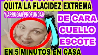COMO QUITAR LA FLACIDEZ Y ARRUGAS EXTREMAS DE CARA,CUELLO Y ESCOTE