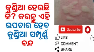 Effective Home Remedies For Skin Allergy|Varkha Mohapatra|How To Treat Skin Allergy At Home|Odia