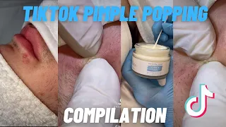 Professional TikTok Pimple Popping Compilation (Satisfying)