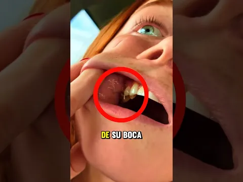 ¡Algo gruñía dentro de su boca😨