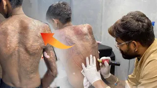 life ka sab se bada scar coverup