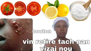 koman pouw retire bouton ak tach nan vizaj ou (remèd natirèl)