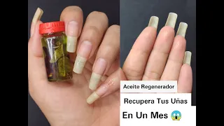 ACEITE REGENERADOR RECUPERA TUS UÑAS EN UN MES.