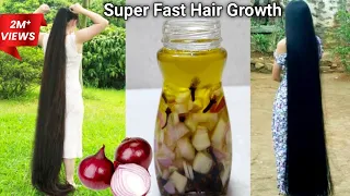 मैंने रात में प्याज मे यह मिलाकर लगाया सुबह बाल 2 इंच लंबे मिले फिर कटवाने पड़े | DIY Onion Oil
