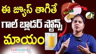 గాల్ బ్లాడర్ స్టోన్స్ ను మాయం చేసే అద్భుతమైన చిట్కా| Best Tips For Gallbladder Stone | Dr Pooja